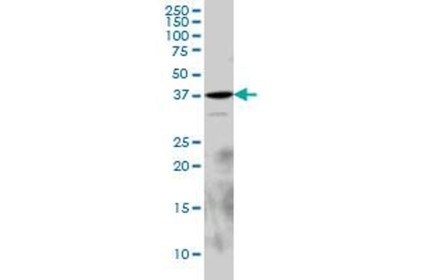 EPM2A Antikörper  (AA 101-199)