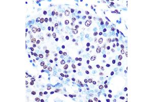 Immunohistochemistry (IHC) image for anti-Splicing Factor Proline/glutamine-Ric (SFPQ) antibody (ABIN7270547)