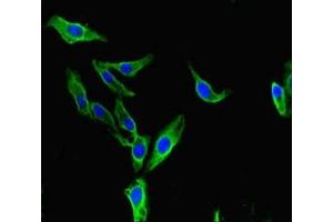 Immunofluorescent analysis of Hela cells using ABIN7145796 at dilution of 1:100 and Alexa Fluor 488-congugated AffiniPure Goat Anti-Rabbit IgG(H+L) (BAZ2A antibody  (AA 97-266))