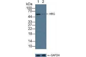 anti-Histidine-Rich Glycoprotein (HRG) (AA 18-254) antibody