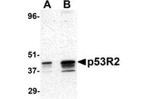 Western Blotting (WB) image for anti-Ribonucleotide Reductase M2 B (TP53 Inducible) (RRM2B) (N-Term) antibody (ABIN1031501) (RRM2B antibody  (N-Term))