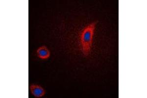 Immunofluorescent analysis of PGHS-2 staining in Jurkat cells.