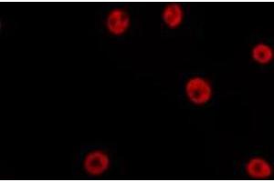 ABIN6275198 staining HepG2 by IF/ICC. (Six5 antibody  (C-Term))