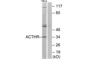 Western blot analysis of extracts from HeLa cells, using ACTHR antibody. (MC2R antibody  (C-Term))