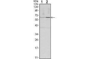 Western blot analysis using CCNB1 mouse mAb against Hela (1) and PC-12 (2) cell lysate. (Cyclin B1 antibody)