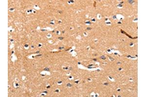 The image on the left is immunohistochemistry of paraffin-embedded Human brain tissue using ABIN7190258(CHRNA3 Antibody) at dilution 1/30, on the right is treated with synthetic peptide. (CHRNA3 antibody)
