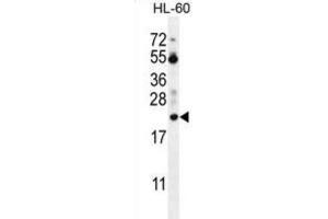 Western Blotting (WB) image for anti-Prothymosin, alpha (PTMA) antibody (ABIN2996364) (PTMA antibody)