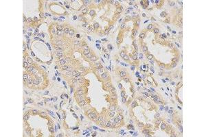 Immunohistochemistry of paraffin-embedded Human kidney using DCTN2 Polyclonal Antibody at dilution of 1:200 (40x lens). (Dynamitin antibody)