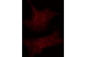 ABIN6275519 staining  Hela cells by IF/ICC. (DVL3 antibody)