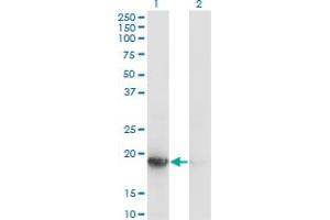 Western Blot analysis of UBE2G1 expression in transfected 293T cell line by UBE2G1 monoclonal antibody (M01), clone 1C12-1B2. (UBE2G1 antibody  (AA 1-170))