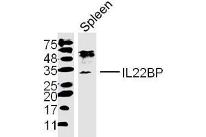 Mouse spleen lysates probed with IL22BP Polyclonal Antibody, unconjugated  at 1:300 overnight at 4°C followed by a conjugated secondary antibody at 1:10000 for 90 minutes at 37°C. (IL22RA2 antibody  (AA 165-263))