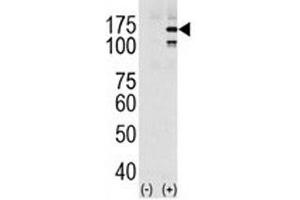 Western blot analysis of EGFR in HeLa cell lysate, either noninduced (Lane 1) or induced with EGF (2). (EGFR antibody  (pTyr1069))