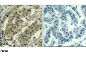 Image no. 1 for anti-V-Akt Murine Thymoma Viral Oncogene Homolog 1 (AKT1) (Thr450) antibody (ABIN319375) (AKT1 antibody  (Thr450))