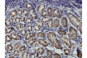 Immunoperoxidase of monoclonal antibody to PRKAR1B on formalin-fixed paraffin-embedded human stomach.