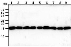 The cell lysates (40ug) were resolved by SDS-PAGE, transferred to PVDF membrane and probed with anti-human Tomm20 antibody (1:1000). (TOMM20 antibody)