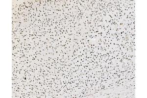IHC analysis of JUNB using anti-JUNB antibody (ABIN7603223).