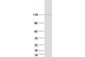Validation with Western Blot (USP15 Protein (Myc-DYKDDDDK Tag))
