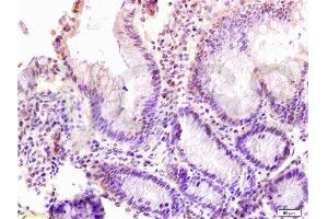 Formalin-fixed and paraffin: rat intestine tissue labeled with Anti-LZTFL1 Polyclonal Antibody , Unconjugated at at 1:200 followed by conjugation to the secondary antibody and DAB staining (LZTFL1 antibody  (AA 101-200))