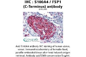 Image no. 1 for anti-S100 Calcium Binding Protein A4 (S100A4) (C-Term) antibody (ABIN1739005) (s100a4 antibody  (C-Term))