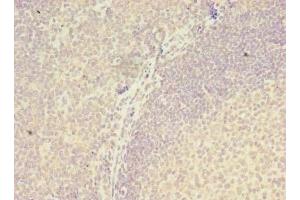 Immunohistochemistry of paraffin-embedded human tonsil tissue using ABIN7175970 at dilution of 1:100 (ZNF238 antibody  (AA 62-364))