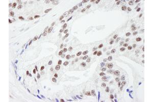 Immunohistochemistry (IHC) image for anti-RAN Binding Protein 3 (RANBP3) (AA 150-200) antibody (ABIN7449009) (RanBP3 antibody  (AA 150-200))