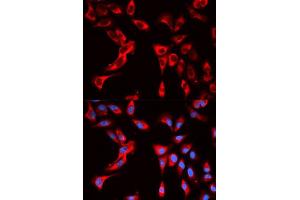Immunofluorescence analysis of U2OS cells using EIF4B antibody. (EIF4B antibody  (AA 352-611))