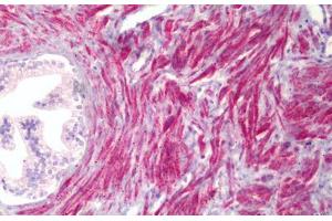 Anti-PMEPA1 antibody IHC staining of human prostate, smooth muscle.