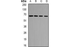 Western blot analysis of ETFDH expression in mouse heart (A), mouse kidney (B), rat liver (C), rat heart (D) whole cell lysates. (ETFDH antibody)