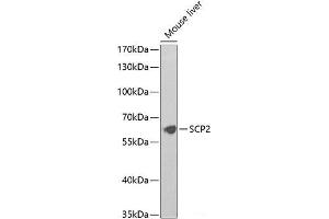 Western blot analysis of extracts of Mouse liver using SCP2 Polyclonal Antibody at dilution of 1:1000. (SCP2 antibody)