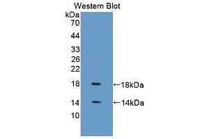 Western blot analysis of the recombinant protein. (FABP4 antibody  (AA 1-125))