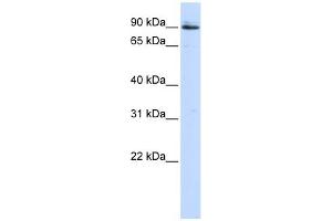 PCSK5 antibody used at 1 ug/ml to detect target protein. (PCSK5 antibody  (Middle Region))