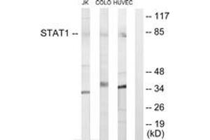 Western blot analysis of extracts from Jurkat cells/COLO205 cells/HuvEc cells, using STAT1 Antibody. (STAT1 antibody  (AA 141-190))