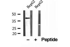 Western blot analysis of extracts of HepG2 cells, using PSAT1 antibody. (PSAT1 antibody  (Internal Region))
