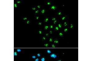 Immunofluorescence analysis of MCF-7 cells using EIF6 Polyclonal Antibody (EIF6 antibody)