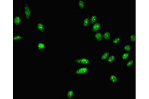 Immunofluorescent analysis of Hela cells using ABIN7163761 at dilution of 1:100 and Alexa Fluor 488-congugated AffiniPure Goat Anti-Rabbit IgG(H+L) (PARN antibody  (AA 1-639))