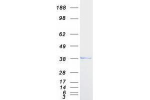 Validation with Western Blot (TOR1A Protein (Myc-DYKDDDDK Tag))
