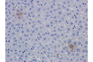 Immunohistochemical analysis of rat liver using anti-TNFalpha antibody   Formalin fixed rat liver slices were stained with a  at 5 µg/ml. (Recombinant TNF alpha (Humicade Biosimilar) antibody)