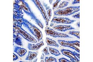 IHC analysis of CD31/Pecam1 using anti-CD31/Pecam1 antibody (ABIN7601662).