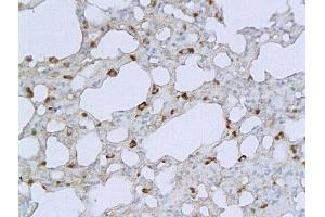 Formalin-fixed and paraffin embedded mouse lung labeled with Anti PRSS10/TMPRSS2 Polyclonal Antibody, Unconjugated (ABIN716876) followed by conjugation to the secondary antibody and DAB staining (TMPRSS2 antibody  (AA 301-400))