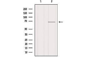 Western blot analysis of extracts from Mouse lung, using Ezrin Antibody. (Ezrin antibody  (C-Term))