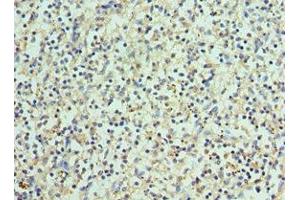 Immunohistochemistry of paraffin-embedded human spleen tissue using ABIN7145171 at dilution of 1:100 (BCL11A antibody  (AA 1-230))