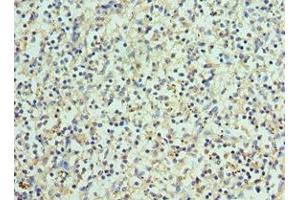 Immunohistochemistry of paraffin-embedded human spleen tissue using ABIN7145171 at dilution of 1:100 (BCL11A antibody  (AA 1-230))