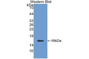 Western Blotting (WB) image for anti-HtrA Serine Peptidase 1 (HTRA1) (AA 10-146) antibody (ABIN1859231) (HTRA1 antibody  (AA 10-146))