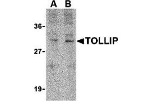 Western Blotting (WB) image for anti-Toll Interacting Protein (TOLLIP) (C-Term) antibody (ABIN1030762) (TOLLIP antibody  (C-Term))