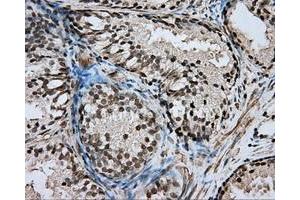 Immunohistochemical staining of paraffin-embedded pancreas tissue using anti-DAPK2 mouse monoclonal antibody. (DAPK2 antibody)