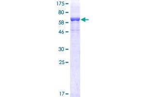 LCAT Protein (AA 1-440) (GST tag)