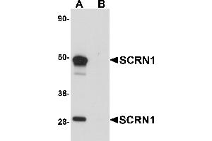 Western Blotting (WB) image for anti-Secernin 1 (SCRN1) (C-Term) antibody (ABIN1030648)