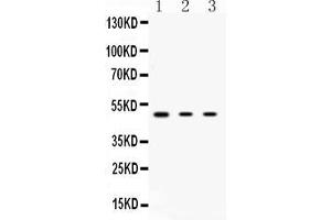 Western blot analysis of PRKAR1A expression in rat thymus extract ( Lane 1), HEPG-2 whole cell lysates ( Lane 2) and MCF-7 whole cell lysates ( Lane 3).