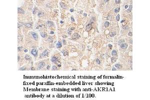 Image no. 1 for anti-Aldo-Keto Reductase Family 1, Member A1 (Aldehyde Reductase) (AKR1A1) antibody (ABIN791183) (AKR1A1 antibody)