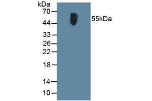 ALT anticorps  (AA 367-480)